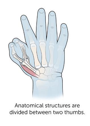 Anatomical structures are divided between two thumbs